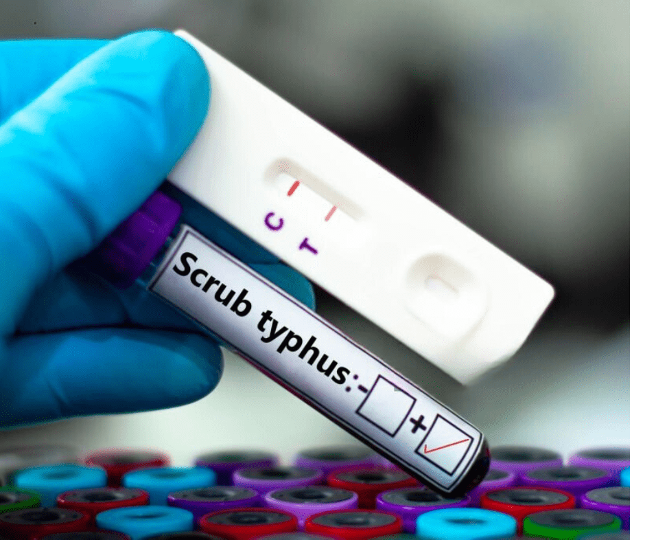 what-is-Scrub-typhus